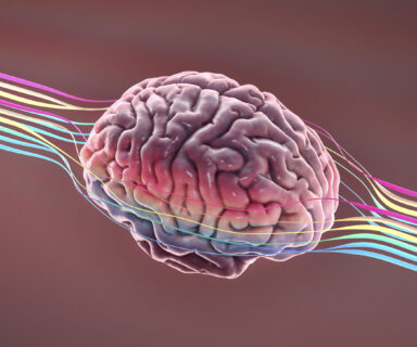 Brain-with-wires